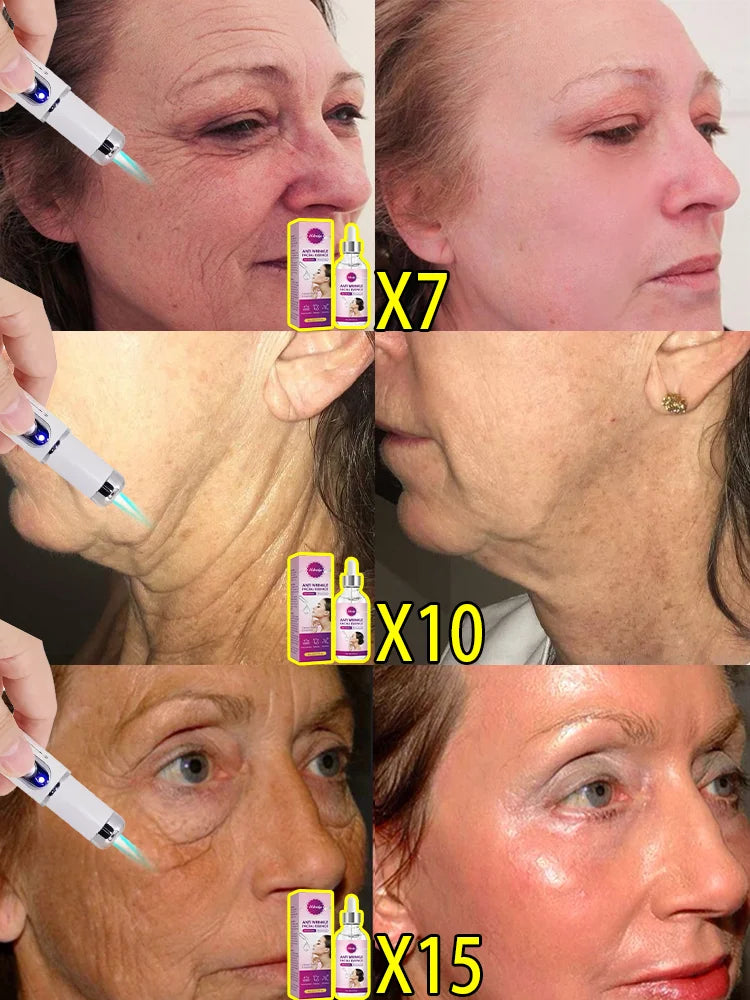 Facial Firming Elevator Laser Pen