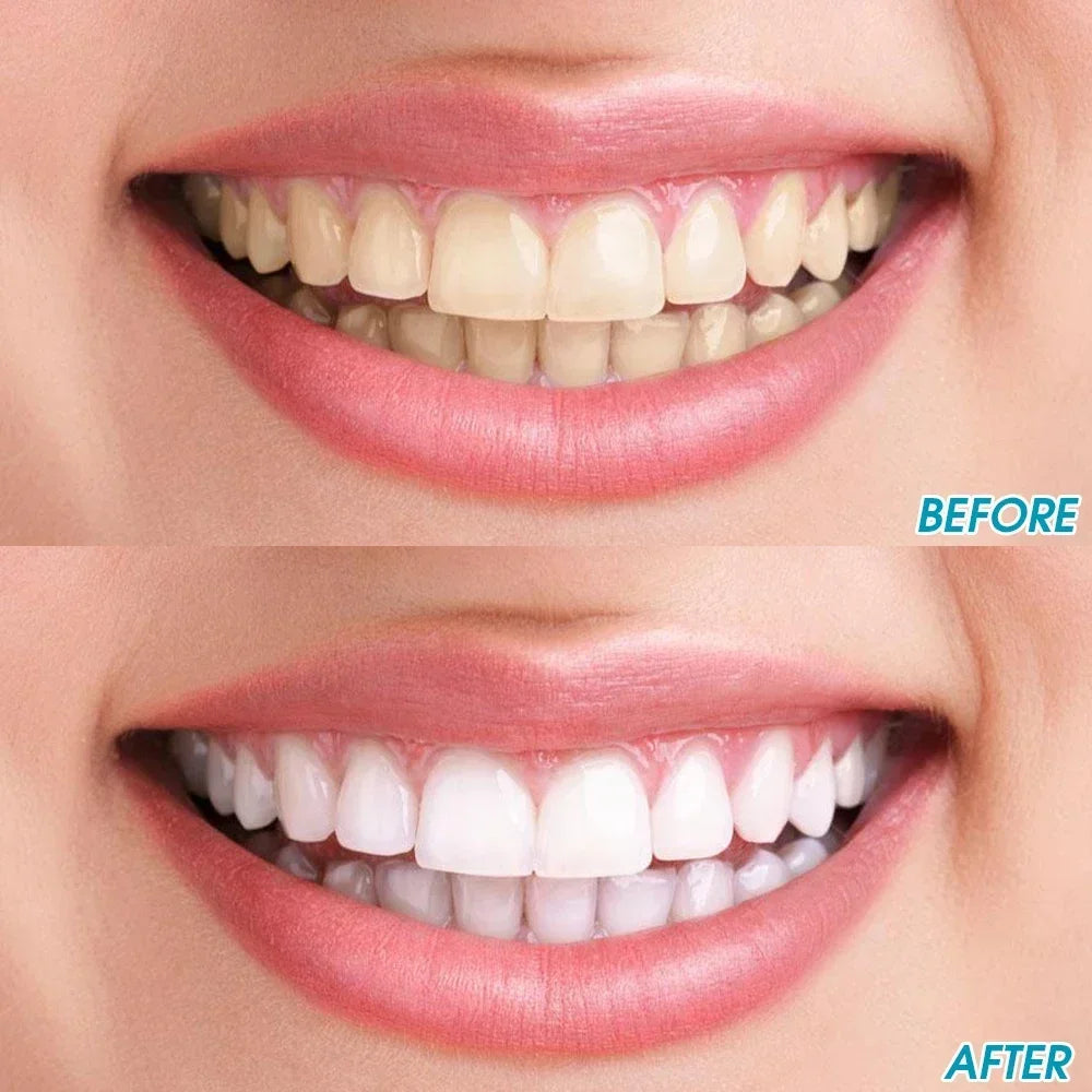 Tooth Stain Deep Cleaning Brush | Deeply Clean Gums Mouth Interdental Brush | No Hurt Teeth | Stain Eraser Remove|  Instant Portable Tool